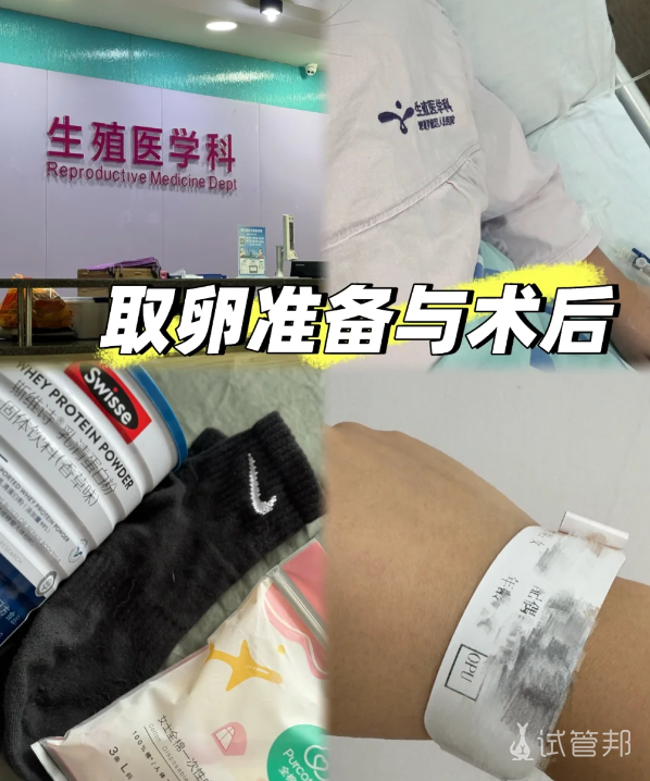 f0228f0831718f185db766514e873433.png 试管婴儿取卵过程分享来了