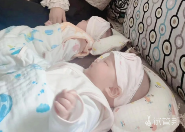44e122155c5ed04492a8772bec948a37.png 双胞胎早产对妈妈有什么影响