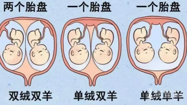 469525a65ef28f4fcccae40a73a81799.png 双胞胎竟有这么多种类你知道什么是同卵双胞胎吗