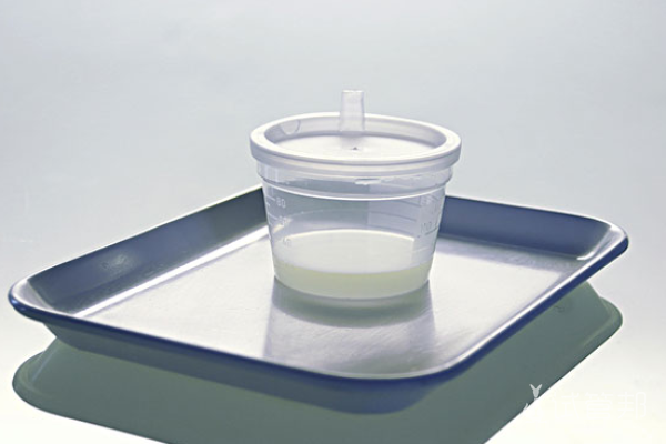 6b4bd3de58c973a242d52e96190927e1.png 男性生精功能检查怎么做