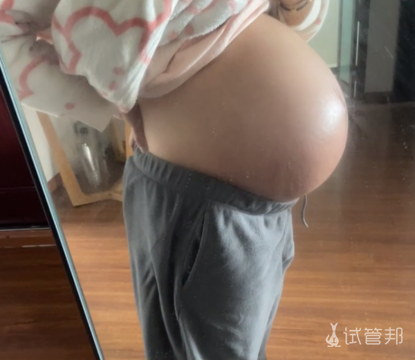 9725d17a5bc0d3f094fbe1107b272a9a.png 想生双胞胎该怎么做这4个方法给大家