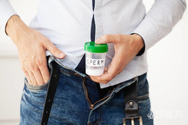 08d2bf95ab23231f5486d9b85b1efe26.png 男性生精功能检查当天能出报告吗