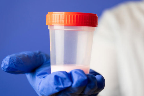 115d155f6c31aa9d3ab84624d07caeff.png 生精功能检查需要空腹吗