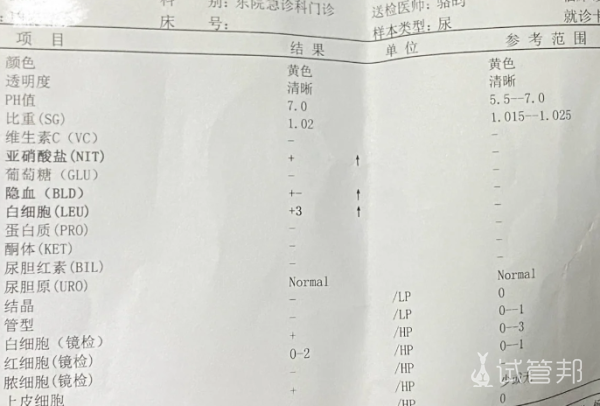 4b6dc3aba67c3ace3babd0f3684e108f.png 尿道炎七大元凶你中招了吗