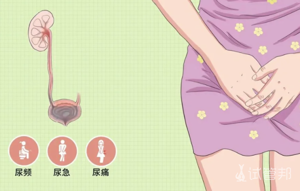 a9dc4ee7866ffed8cce1c1180ea4f777.png 尿路感染大作战我亲历的全方位检查清单