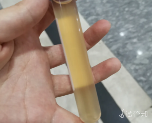 b12bf58d6cf4683887743c696e1b671e.png 同房后竟遭遇尿路感染该怎么办