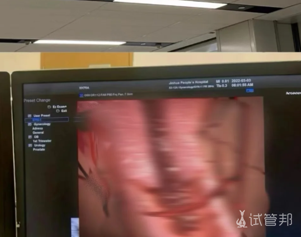 3d21e406c2cdcbdd8af481c8b0b56b87.png 姐妹你要是也有痛经一定要及时调理