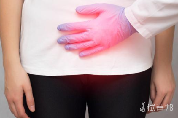 79e768b860e8dcf3d1851d6b3a4a721e.png 黄体破裂可以自愈吗