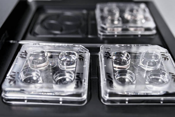 ce65025b4d433374e6a6aa36f4eb55c3.png 美国第三代试管婴儿医院怎么选