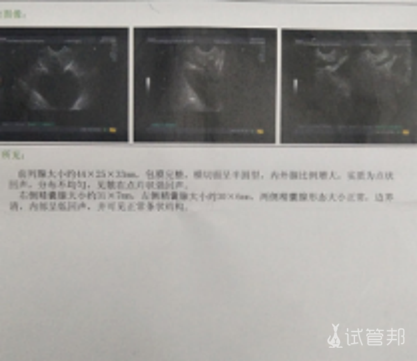 8907d64ffee6a26ce5a20e9f91a90c34.png 精囊炎到底要怎么治疗啊