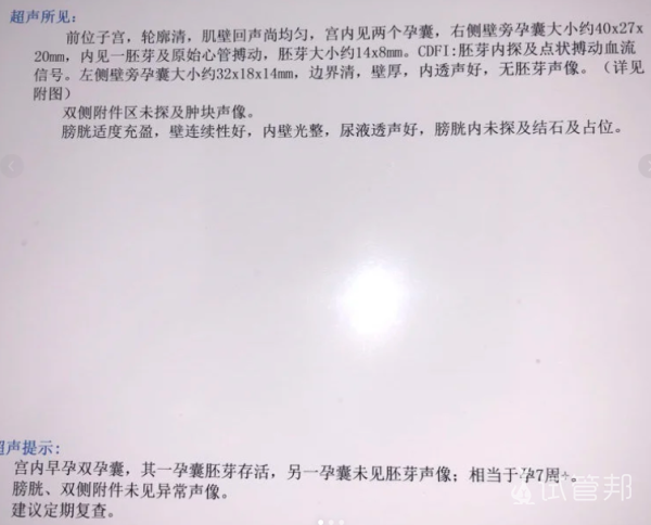 8caa81d8e80a1c5976f9463773db328d.png 多胎妊娠背后隐藏的七大风险