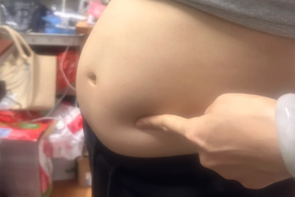 cd75b871e0228bb94cd2a2550bbf9621.png 想通过试管婴儿生多胞胎