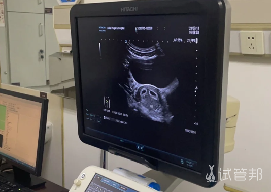 d9c5a44cd8d87814537784a32598fd3f.png 多胎妊娠是什么感受说说我这孕36周的心路历程