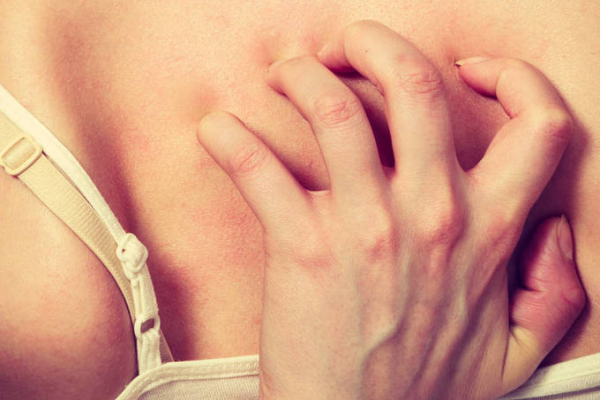 6a7d1afd8b54fd39ab42d746e94873b7.png 荨麻疹和麻疹是一样的吗