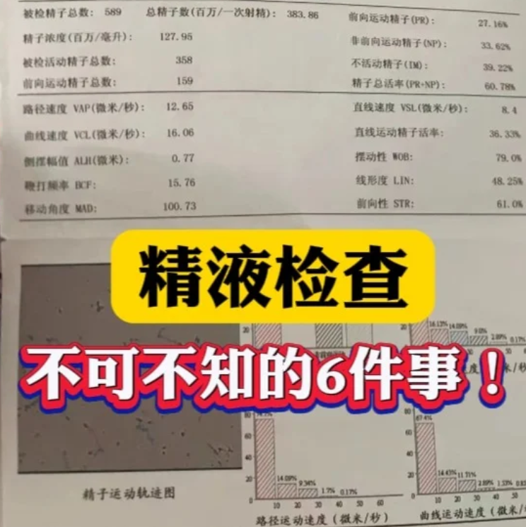 做精液检查这6件事要知道