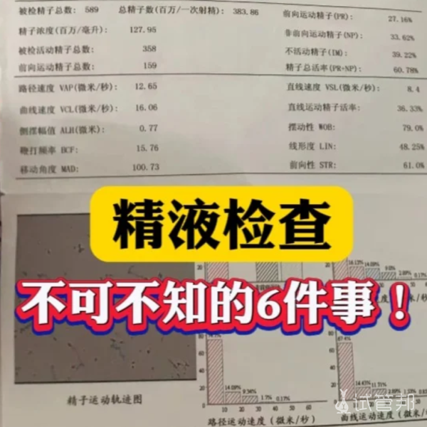 d093c433f4b0603d6d05b6a2df0b6c28.png 做精液检查这6件事要知道