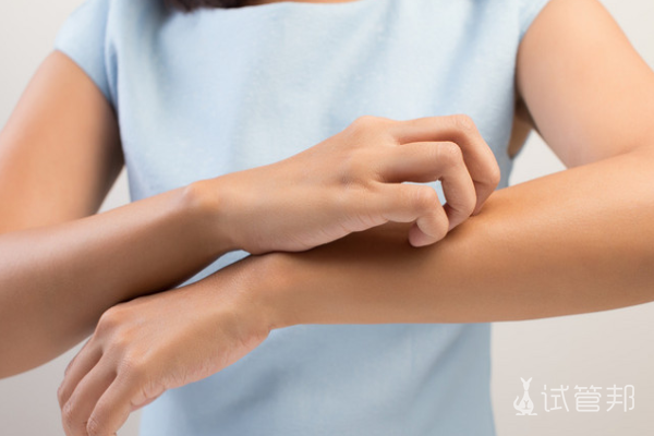 d88849e271b043d9647d1035a373ec95.png 荨麻疹皮肤病是怎么回事