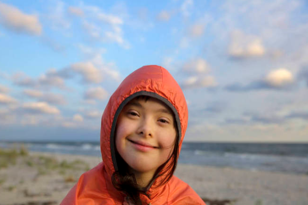 69b69e2f03927682eb738785cf0b24ba.png 唐氏综合征治疗方法有哪些