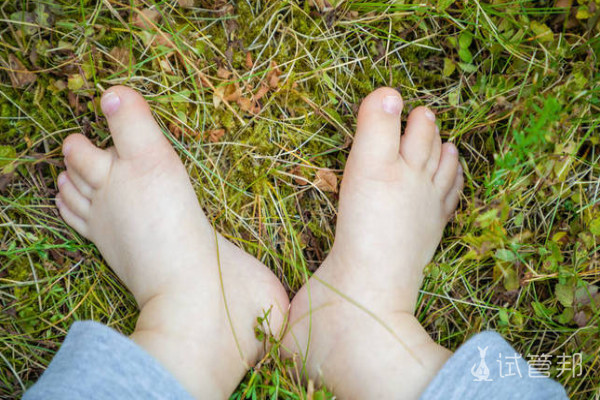 13d39a0605ba834a10788dd6a4e54065.png 唐氏综合征表现有哪些