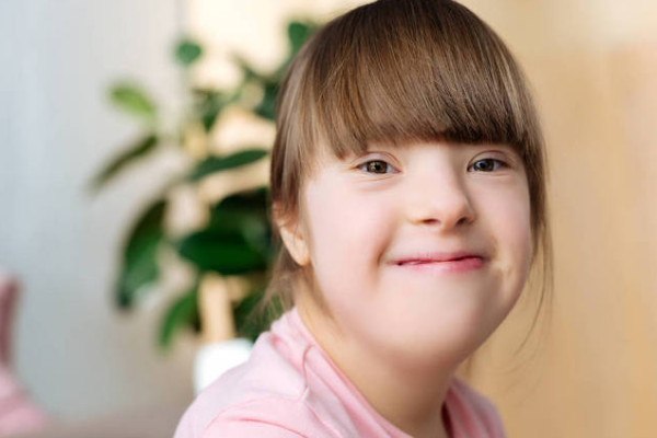 47daa71bf15d3e135f7937b74c2084fb.png 唐氏综合征小孩儿能不能要