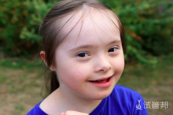 b46ffa2d1e56ab873537997078a85628.png 先天性唐氏综合症指的是什么