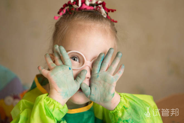 e316dd00fd0adbc9c893429e14abc300.png 唐氏综合征的发生与病毒有关吗