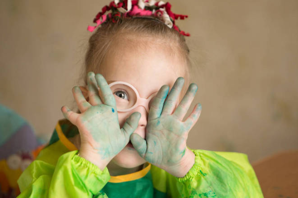 058ed3419630c704504092ddc2cdcb52.png 小儿唐氏综合征是怎么回事