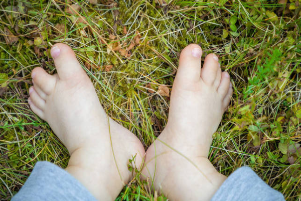 2d785a32af29be3bbe718590ac2b22e7.png 唐氏综合征小孩有什么明显症状