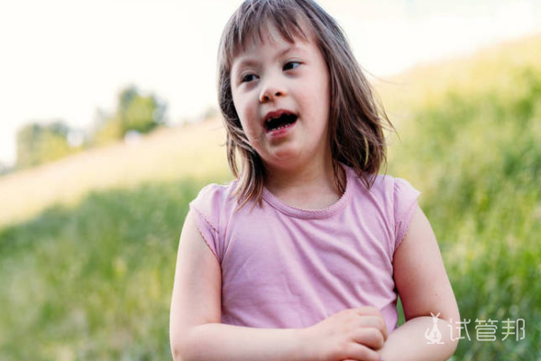 528f472588bd652f573ea0956613e5d4.png 唐氏综合征怎么导致的