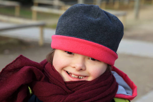 8a8f1514a508757fb4bbb9526f67fc04.png 唐氏综合症风险度如何看