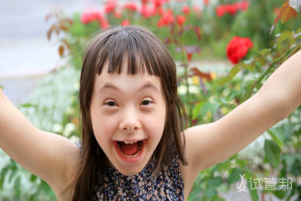 a153893ab1d229138e0e1b1ad5b3eb22.png 唐氏综合症指的是什么