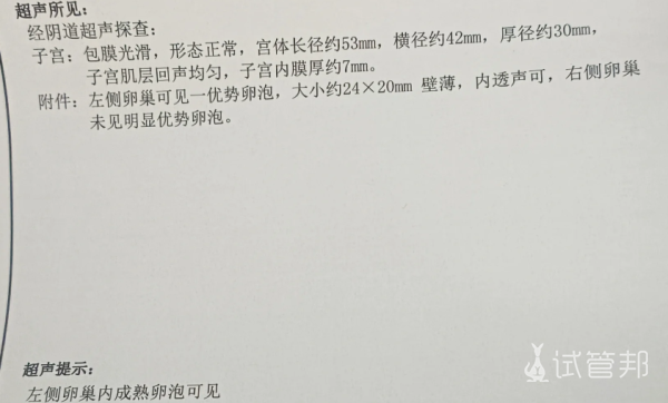 30feb8dad85769da2b6c5775f3102c28.png 卵泡监测或促排卵期间千万不要轻易换医院