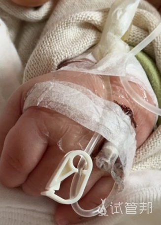 90e64bd4c2a33bebd939b873d2f59e62.png 宝宝的附睾炎终于好了