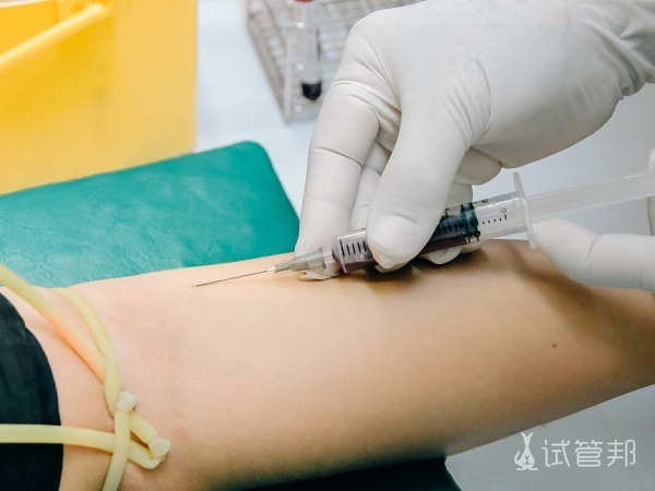 1e61778dd46a559eaf04f8ab600af7db.jpg 孕前检查多少钱