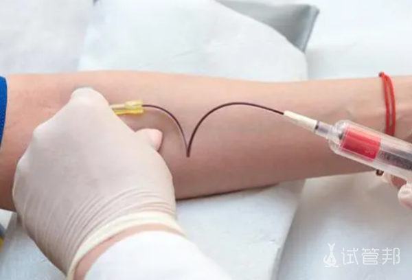 a465caf2e642efcad9ce2a6abc9baca1.png 胚胎染色体检查多少钱