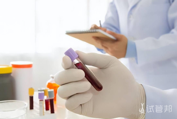 c9b020c1a29f52230da240798fffc6d5.png 胚胎染色体检查和男女双方染色体检查区别