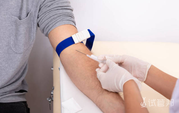 05ad614499bab2d6d3609bd588ae6c73.png 男性孕前检查要禁欲几天