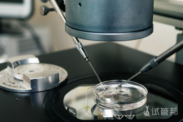 3e8ec55d7dccef8479b206de0b803a04.png 试管婴儿移植后需要通过几关