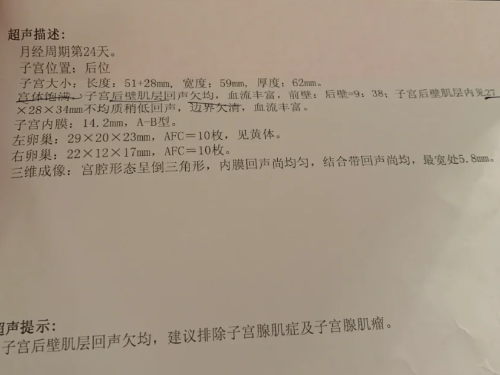 说说我是怎么发现自己得了子宫内膜异位症的