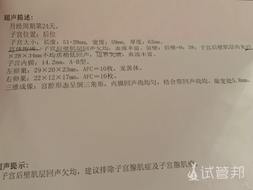 be79ceb5c303a6725b657fa2d765c88c.png 说说我是怎么发现自己得了子宫内膜异位症的