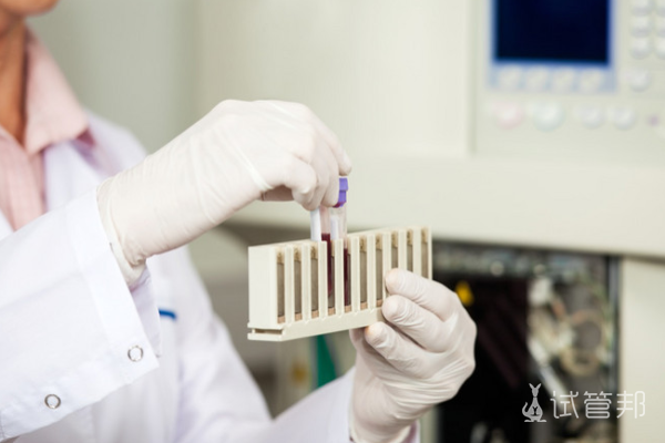 7e522d3377f57b60a1911a2b9f9d2e26.png 新生儿遗传代谢病筛查时间是什么时候