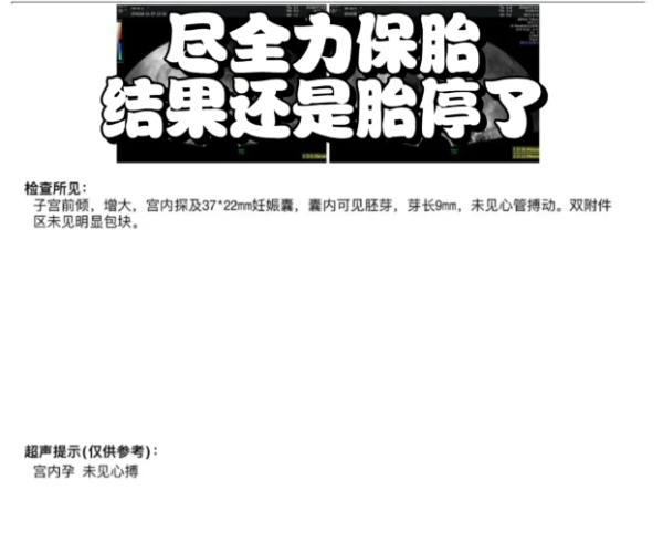 93617b94d639389d899a1f8ea8b79f47.png 确诊多囊从人授转做试管依然失败不知道怎么办了