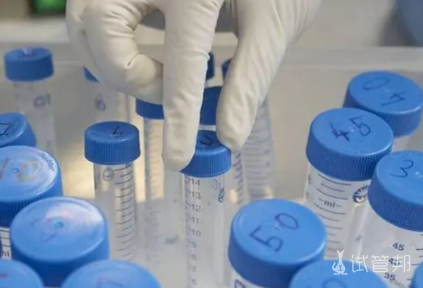 16a98015cf80f607330744bdb7be5473.png 人工授精的费用及过程