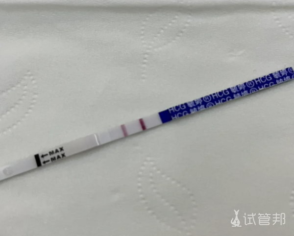 5d39b0a84ed832ffae2adfa2ab313ae2.png 结婚十年生娃路真的很波折