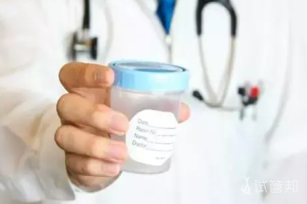 859e6eae616610ba59970d616afe3309.png 哪些人群精子质量会出现问题