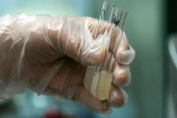 bf2f8ecabb114e48076971cf5ed5760d.png 精子质量受哪些因素影响