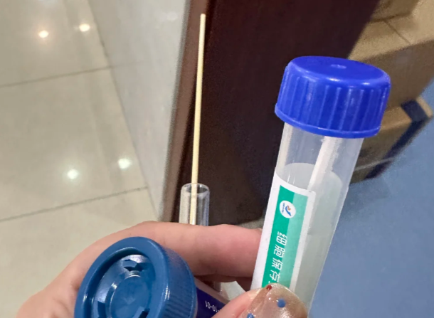 白带发黄别担心选对药物是关键