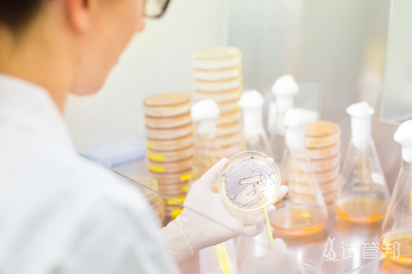 7cdbc1de49111c47b35f84cb71190bf9.png 男性生精质量需要做什么检查