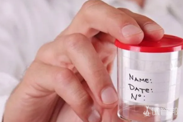 92aa31d55bc9afa759a438b1c64942e1.png 男性弱精成活率怎么回事