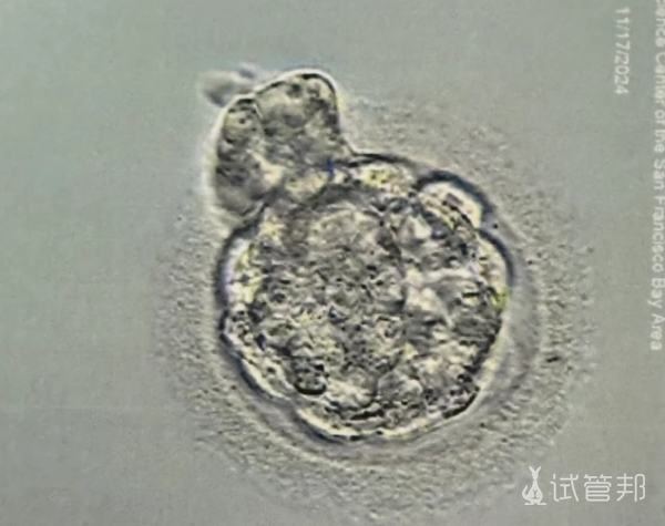 e993a4ad6110814bdbb8d02f5ac64ad4.png 试管婴儿二促一移失败了什么时候我能成功啊